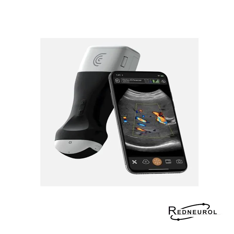 Clarius -Software Doppler Pulsado y Dicom